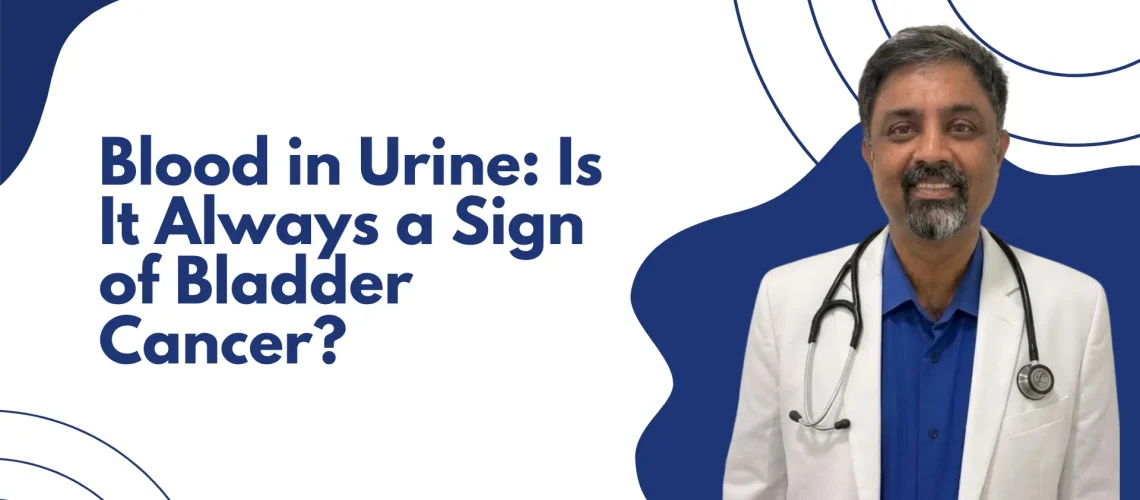 Best Bladder Cancer Doctor in Hebbal 