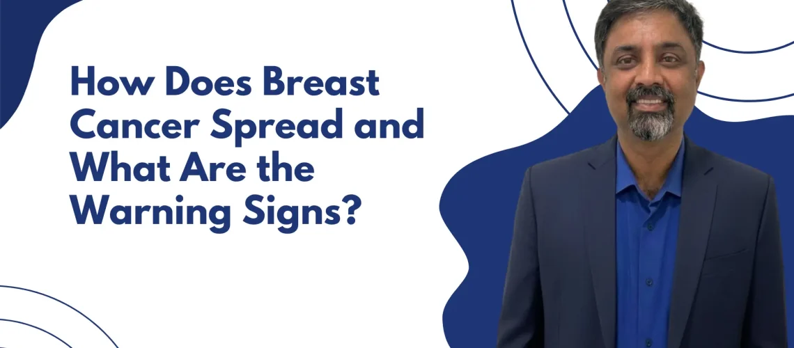 Best Breast Cancer Doctor in Hebbal