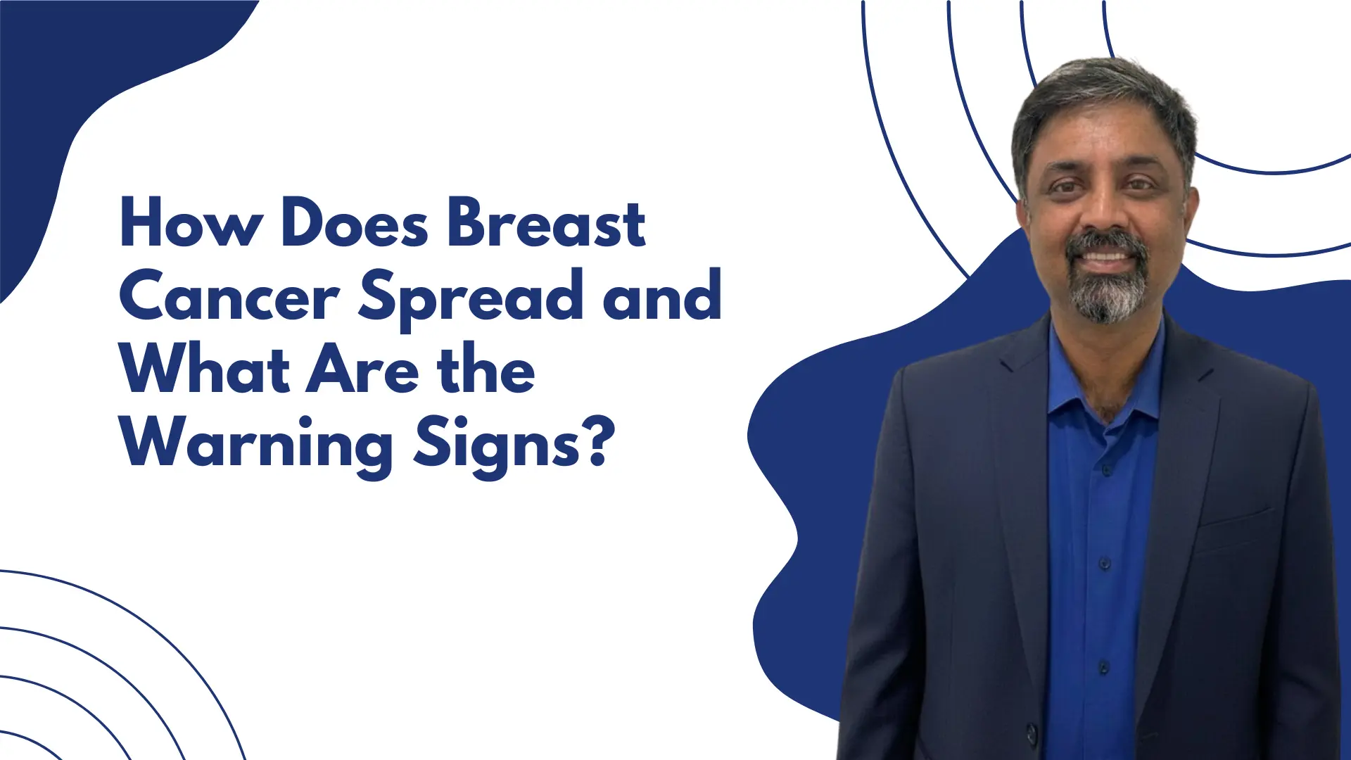 Best Breast Cancer Doctor in Hebbal